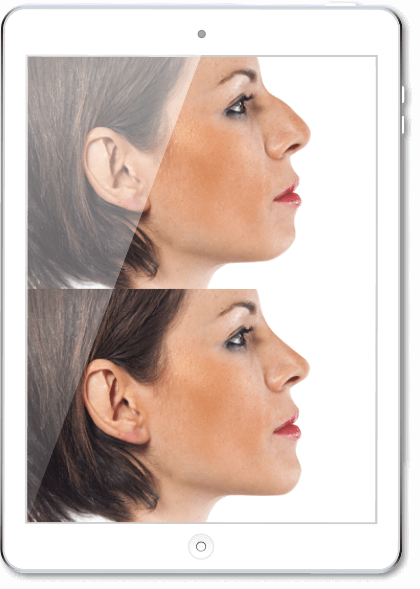 Example before and after